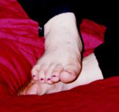 Closeup